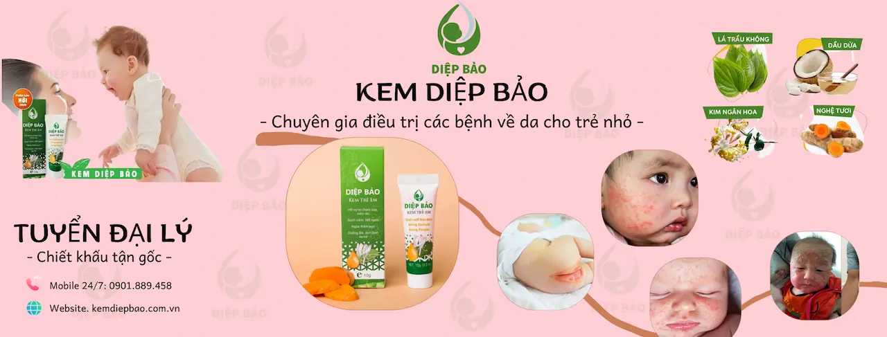 Kem Diệp Bảo Là 1 Thảo Dược Đông Y Gia Truyền Với Chất Lượng Tuyệt Vời Được Kiểm Chứng Bởi Hàng Triệu Bà Mẹ Tin Dùng Cho Trẻ Sơ Sinh & Trẻ Nhỏ.